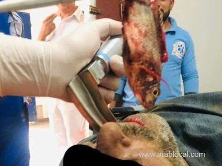 -live-fish-removed-from-fisherman-windpipe-saudi