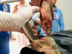-live-fish-removed-from-fisherman-windpipe_UAE