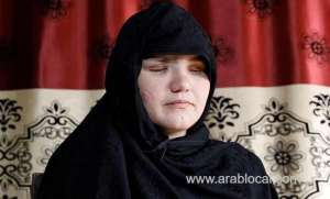afghan-woman-working-as-a-cop-shot-and-stabbed-in-the-eyes-for-getting-a-job_UAE