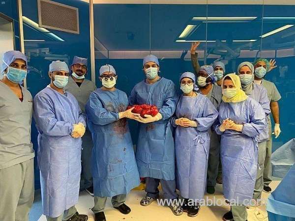medical-team-removes-7kg-tumor-from-womans-abdomen-saudi