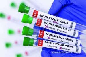 saudi-arabia-reported-2-new-monkeypox-cases-bringing-total-to-3_UAE