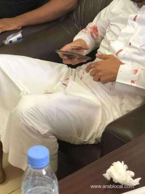 teacher-sustains-broken-nose-in-classroom-attack_UAE