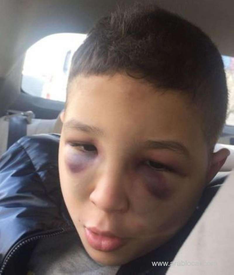 saudi-autistic-boy-was-physically-abused-at-a-center-saudi