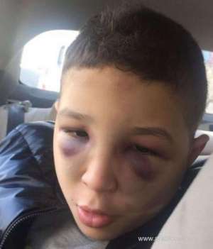 saudi-autistic-boy-was-physically-abused-at-a-center_UAE