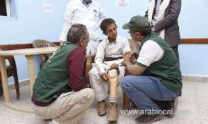 saudi-arabia’s-relief-center-prosthetic-limbs-project-benefits-1,839-yemenis_UAE