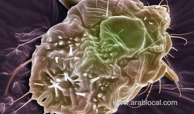 2,156-cases-of-scabies-were-reported-and-cured-in-makkah---ministry-of-health-saudi