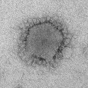 health-ministry-reported-the-first-mers-cov-infection-from-riyadh-saudi
