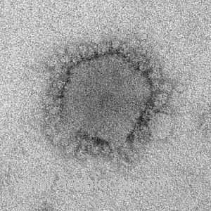 health-ministry-reported-the-first-mers-cov-infection-from-riyadh_UAE