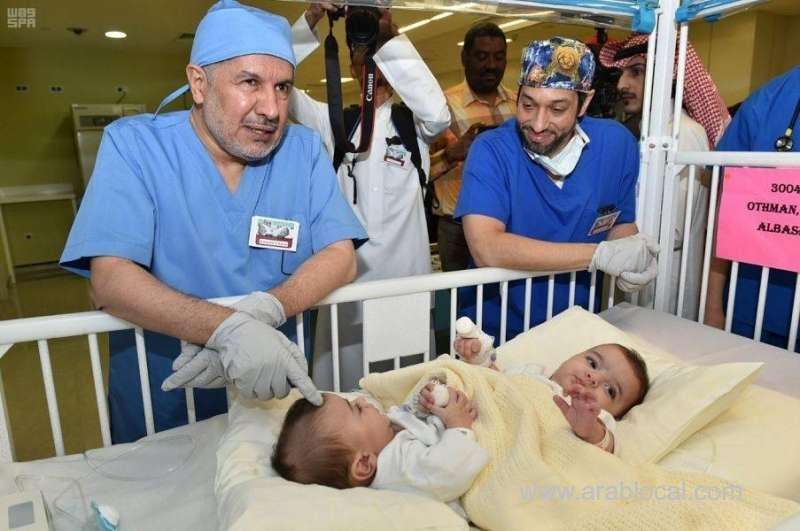 libyan-conjoined-twins-successfully-separated-saudi