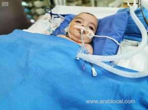 libyan-twins-are-in-stable-condition-five-days-after-surgery_UAE