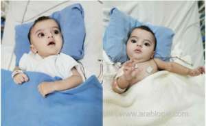 top-saudi-surgeon-visits-separated-conjoined-twins_UAE