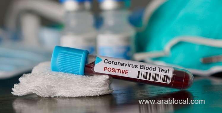 saudi-confirms-133-new-corona-cases-total-900-cases-saudi