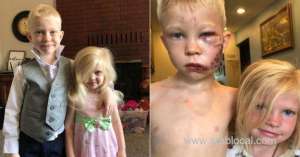 boy-gets-90-stitches-after-saving-little-sister-from-dog-attack_UAE